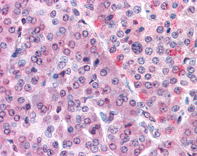 MLEC Antibody in Immunohistochemistry (Paraffin) (IHC (P))