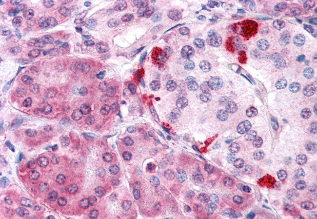 MLEC Antibody in Immunohistochemistry (Paraffin) (IHC (P))