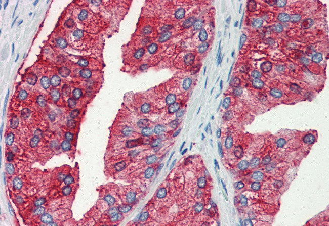 MUC13 Antibody in Immunohistochemistry (Paraffin) (IHC (P))