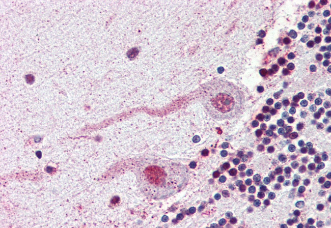 NEK7 Antibody in Immunohistochemistry (Paraffin) (IHC (P))