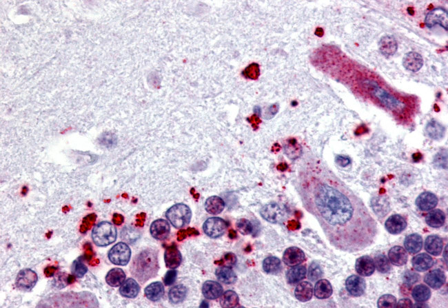 NPBWR1 Antibody in Immunohistochemistry (Paraffin) (IHC (P))