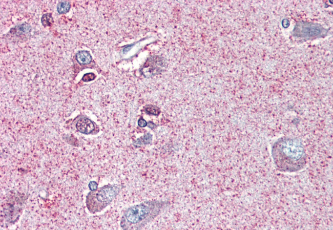 NTSR2 Antibody in Immunohistochemistry (Paraffin) (IHC (P))