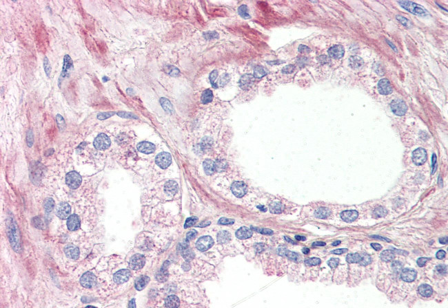 OR51E1 Antibody in Immunohistochemistry (Paraffin) (IHC (P))