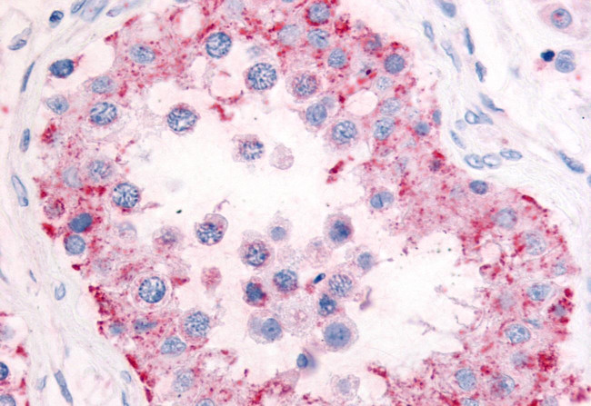 PDE11A Antibody in Immunohistochemistry (Paraffin) (IHC (P))
