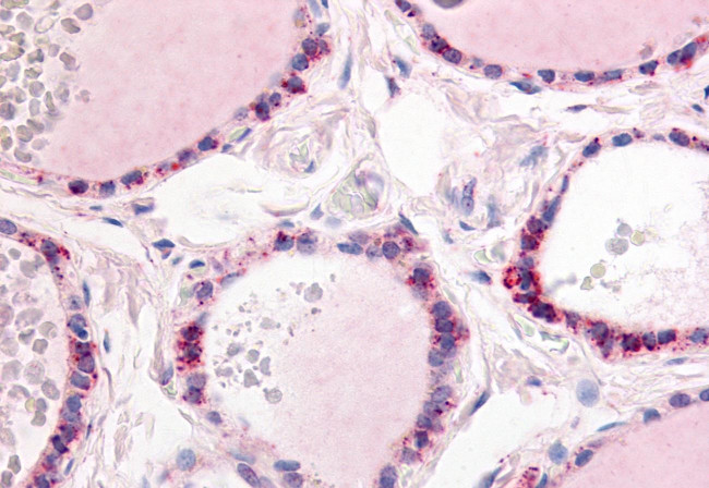 PDE1C Antibody in Immunohistochemistry (Paraffin) (IHC (P))