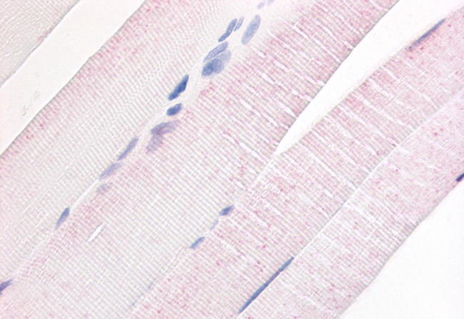 PDE7A Antibody in Immunohistochemistry (Paraffin) (IHC (P))