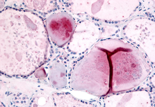 PDE8B Antibody in Immunohistochemistry (Paraffin) (IHC (P))