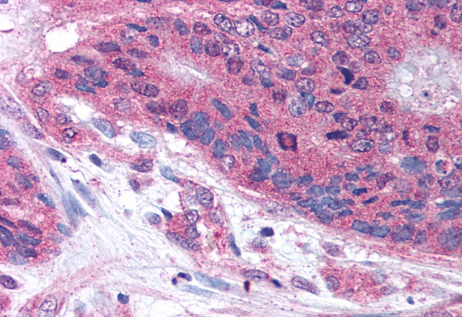 PLA2G3 Antibody in Immunohistochemistry (Paraffin) (IHC (P))