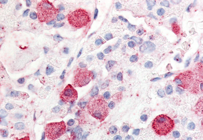GPR10 Antibody in Immunohistochemistry (Paraffin) (IHC (P))