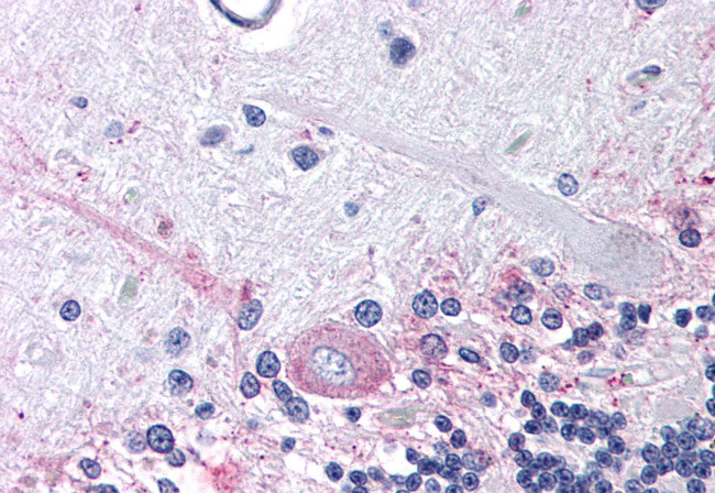 PTGER3 Antibody in Immunohistochemistry (Paraffin) (IHC (P))