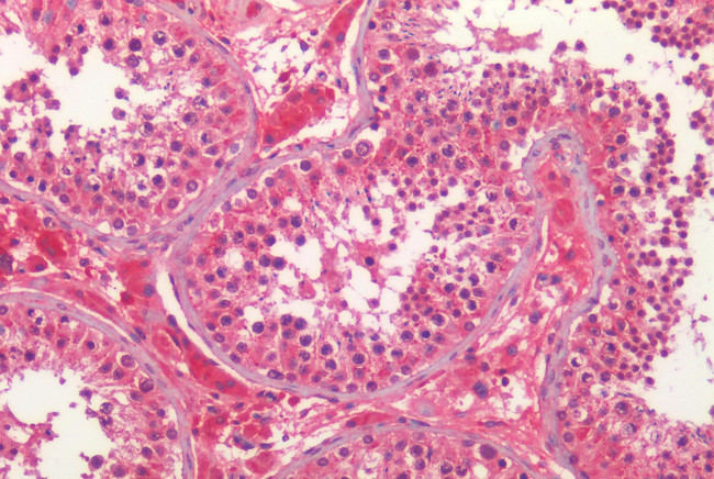 PTGES Antibody in Immunohistochemistry (Paraffin) (IHC (P))