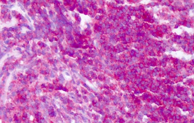 CD45 Antibody in Immunohistochemistry (Paraffin) (IHC (P))