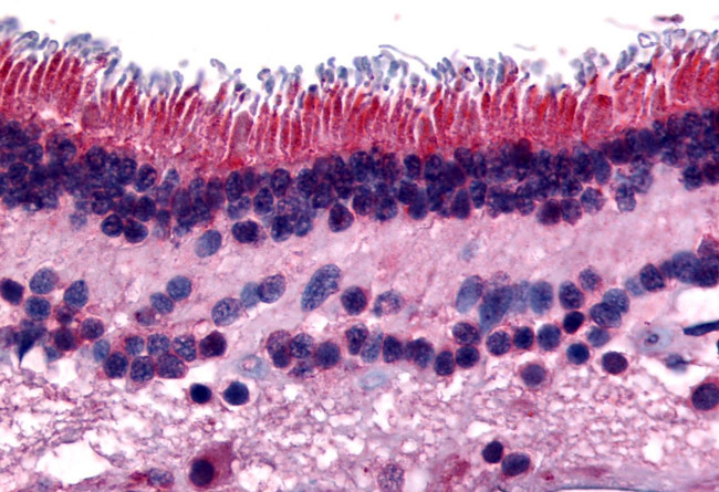PTPRM Antibody in Immunohistochemistry (Paraffin) (IHC (P))