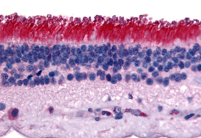 PTPRM Antibody in Immunohistochemistry (Paraffin) (IHC (P))