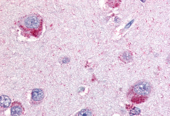 GPBB Antibody in Immunohistochemistry (Paraffin) (IHC (P))