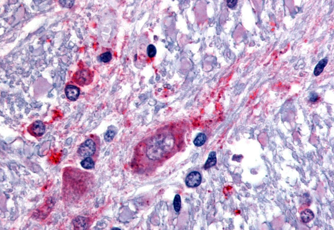 SLC5A3 Antibody in Immunohistochemistry (Paraffin) (IHC (P))