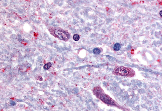 SLC5A3 Antibody in Immunohistochemistry (Paraffin) (IHC (P))