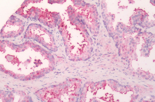 SLC5A3 Antibody in Immunohistochemistry (Paraffin) (IHC (P))