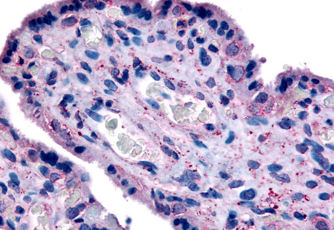 SLC7A5 Antibody in Immunohistochemistry (Paraffin) (IHC (P))