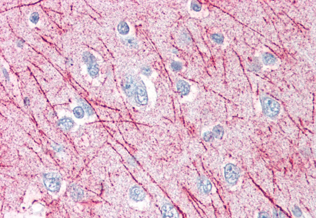 SRPX2 Antibody in Immunohistochemistry (Paraffin) (IHC (P))