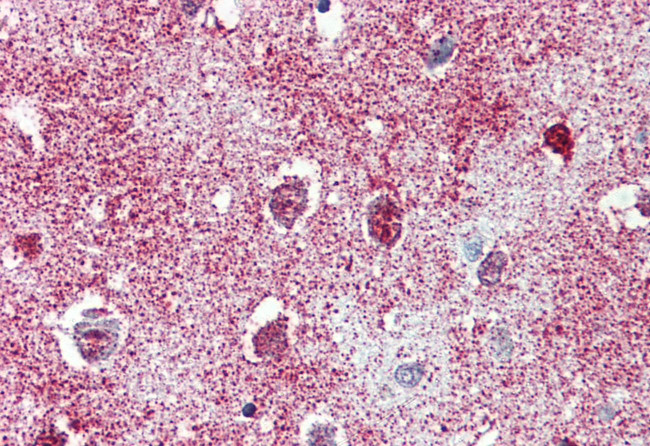 TAOK1 Antibody in Immunohistochemistry (Paraffin) (IHC (P))