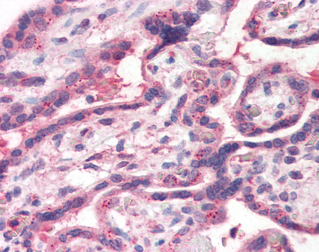 TFF2 Antibody in Immunohistochemistry (Paraffin) (IHC (P))