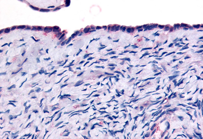 THRA Antibody in Immunohistochemistry (Paraffin) (IHC (P))