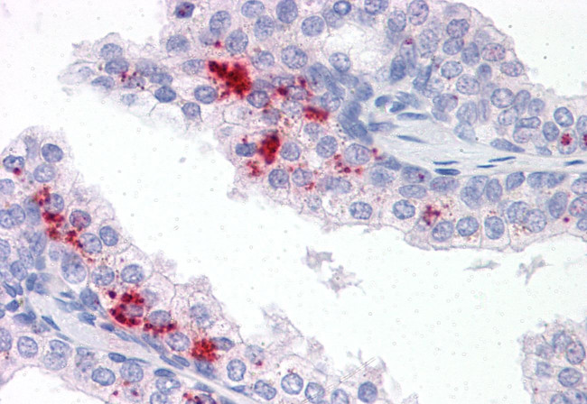 TM9SF1 Antibody in Immunohistochemistry (Paraffin) (IHC (P))