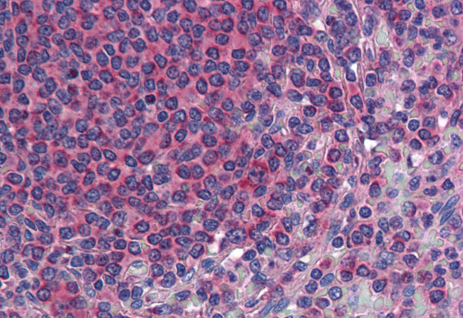 TM9SF3 Antibody in Immunohistochemistry (Paraffin) (IHC (P))