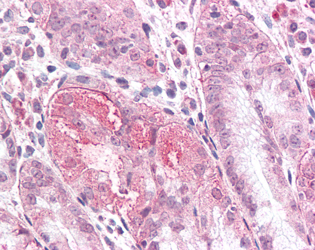 TMEM33 Antibody in Immunohistochemistry (Paraffin) (IHC (P))