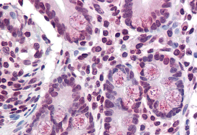 TMPRSS4 Antibody in Immunohistochemistry (Paraffin) (IHC (P))