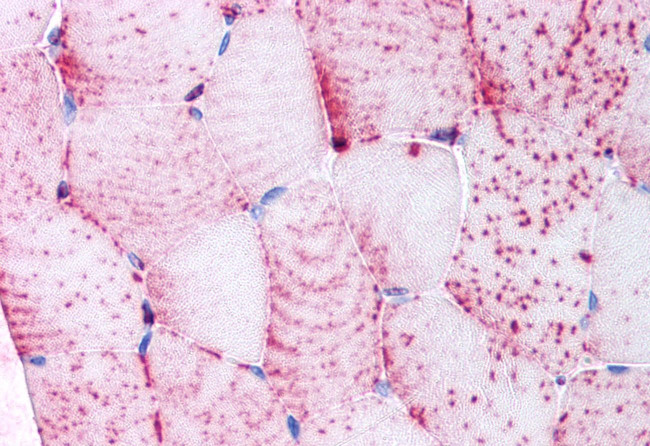 TNIK Antibody in Immunohistochemistry (Paraffin) (IHC (P))