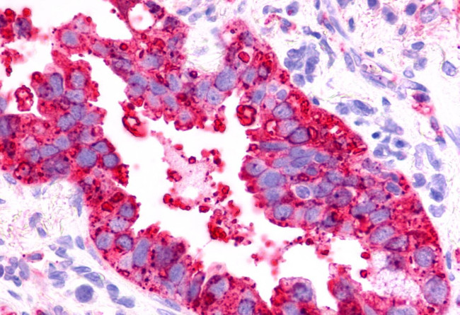 TPRA1 Antibody in Immunohistochemistry (Paraffin) (IHC (P))