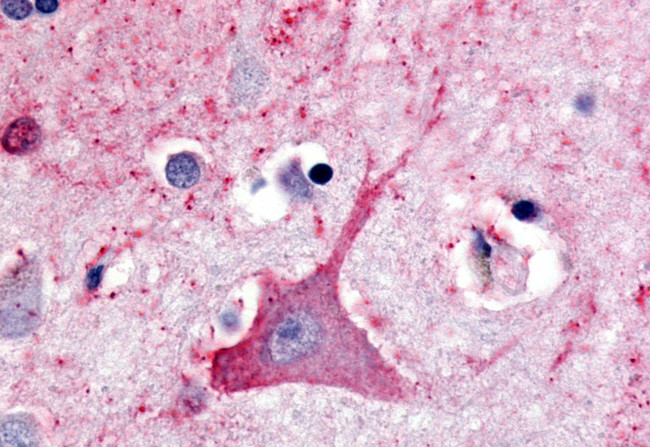 TRHR Antibody in Immunohistochemistry (Paraffin) (IHC (P))