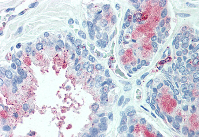 TSPAN13 Antibody in Immunohistochemistry (Paraffin) (IHC (P))
