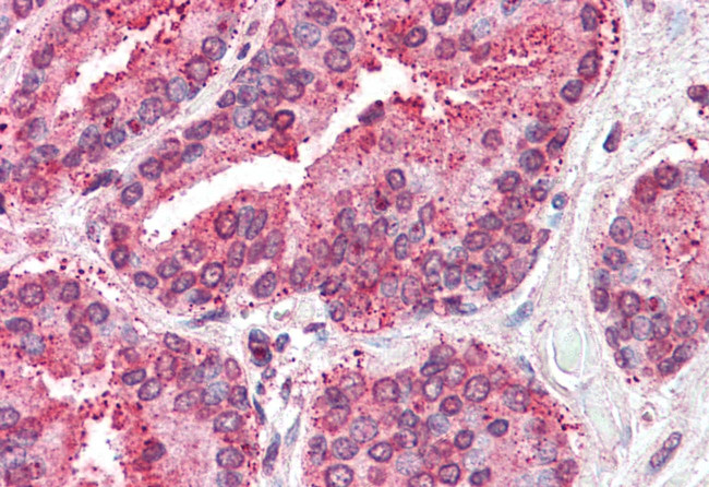 TSPAN6 Antibody in Immunohistochemistry (Paraffin) (IHC (P))