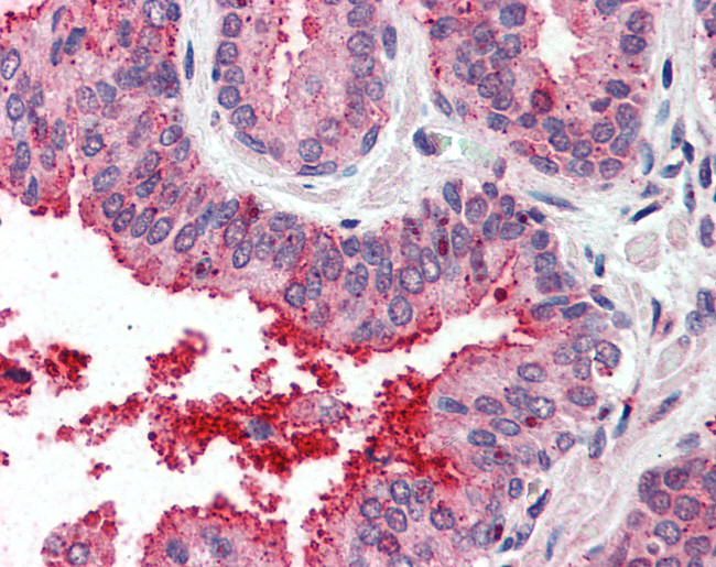 TSPAN6 Antibody in Immunohistochemistry (Paraffin) (IHC (P))