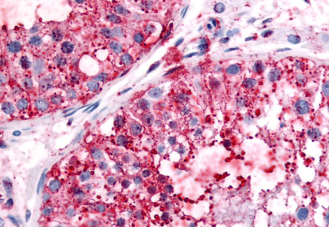 UCHL3 Antibody in Immunohistochemistry (Paraffin) (IHC (P))