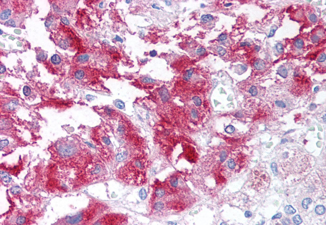 USP20 Antibody in Immunohistochemistry (Paraffin) (IHC (P))