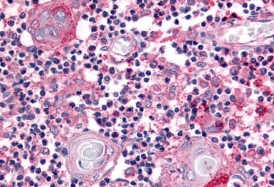 USP4 Antibody in Immunohistochemistry (Paraffin) (IHC (P))