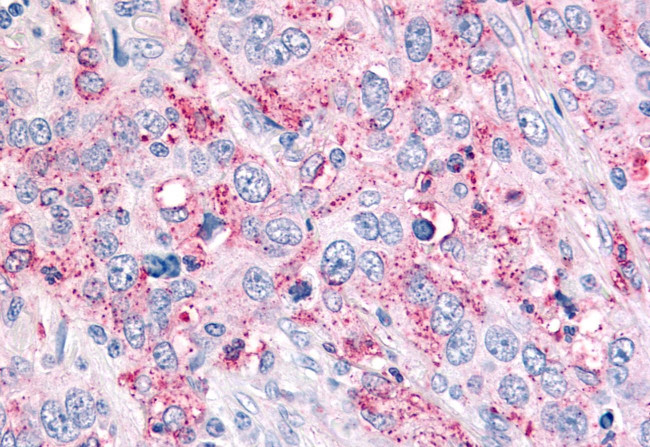 USP4 Antibody in Immunohistochemistry (Paraffin) (IHC (P))