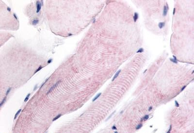 WNK1 Antibody in Immunohistochemistry (Paraffin) (IHC (P))