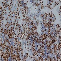 Rat IgG2b Isotype Control in Immunohistochemistry (IHC)