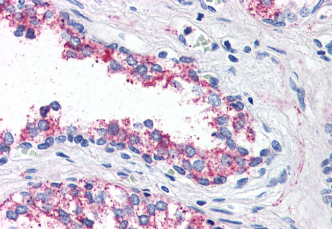 HTR1B Antibody in Immunohistochemistry (Paraffin) (IHC (P))