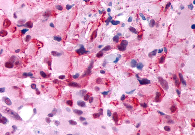HTR2B Antibody in Immunohistochemistry (Paraffin) (IHC (P))
