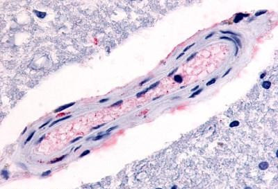 HTR4 Antibody in Immunohistochemistry (Paraffin) (IHC (P))