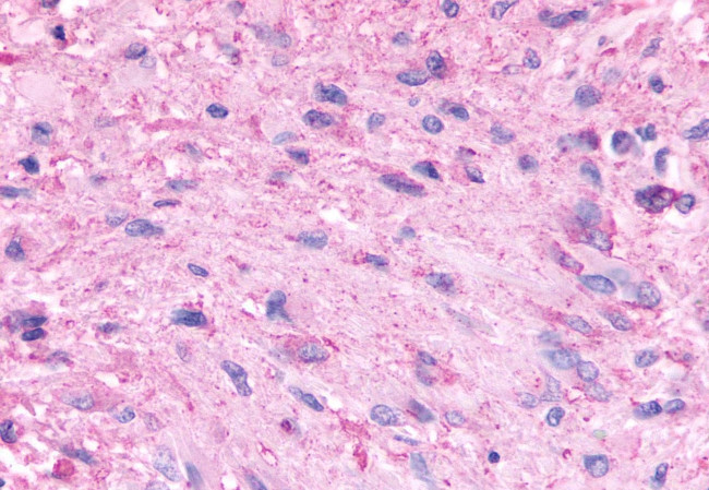 HTR5A Antibody in Immunohistochemistry (Paraffin) (IHC (P))
