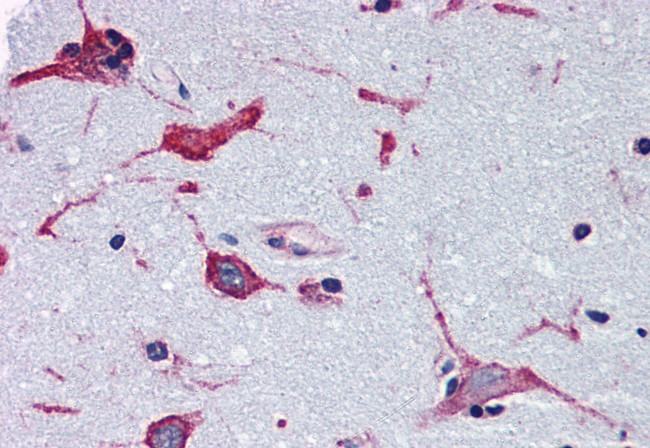 ADORA2B Antibody in Immunohistochemistry (Paraffin) (IHC (P))
