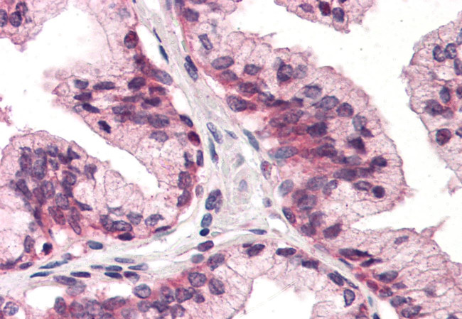 CD298 Antibody in Immunohistochemistry (Paraffin) (IHC (P))