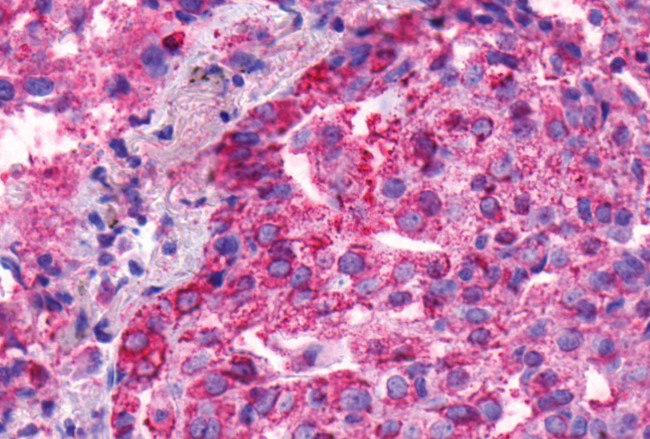 BAI1 Antibody in Immunohistochemistry (Paraffin) (IHC (P))